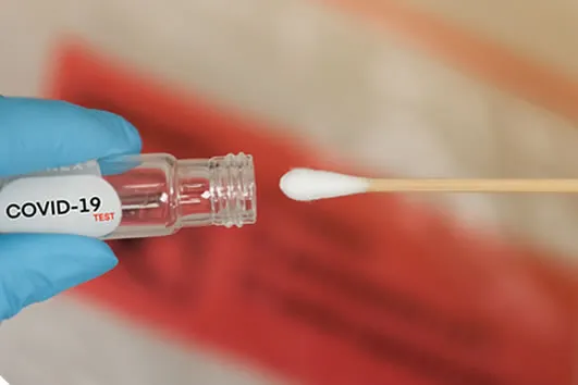 Test RT-PCR Covid-19 Hisopado