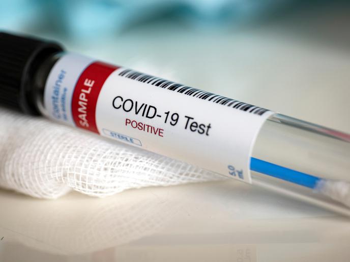 Test Covid-19